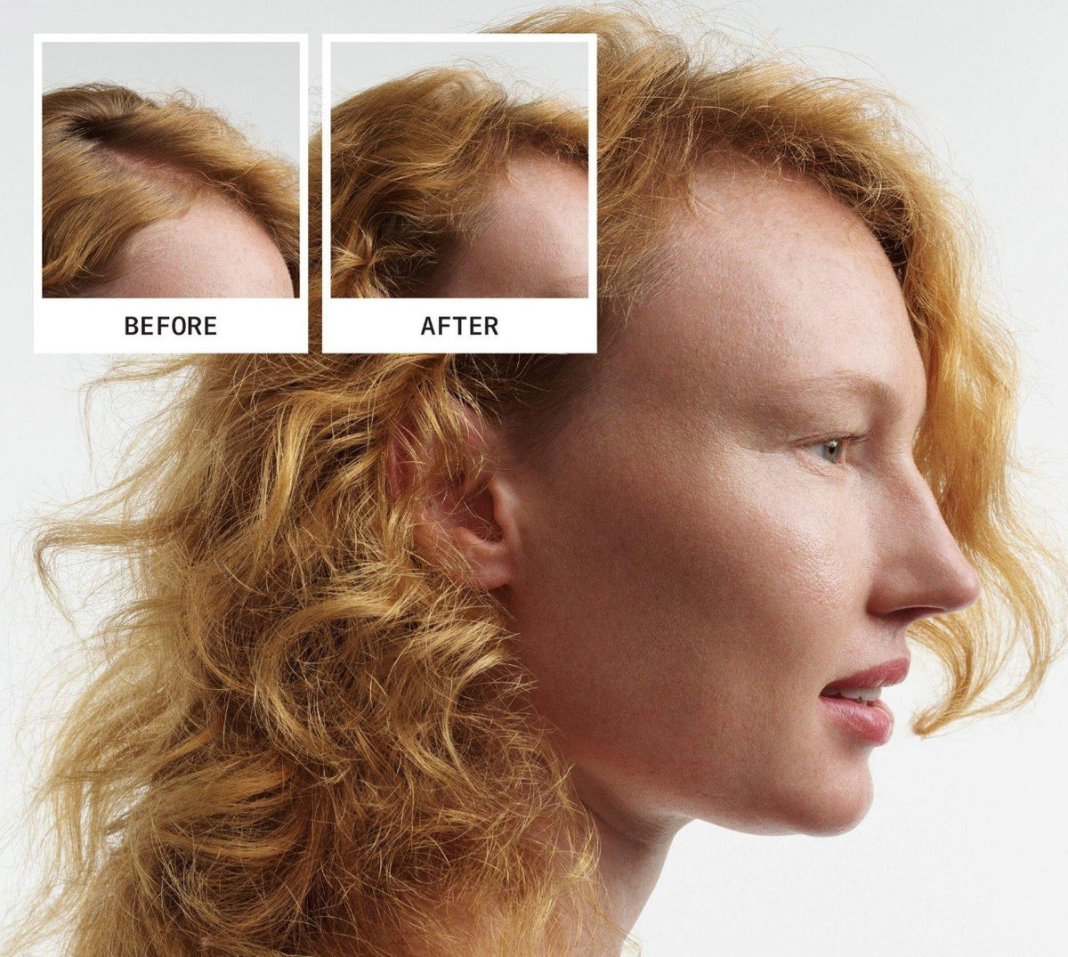 SHAMPOO DERMOPURIFICANTE PARA CABELLO TEÑIDO CON ADELGAZAMIENTO AVANZADO NIOXIN PRO 1L
