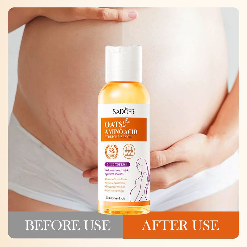 ACEITE CORPORAL PARA ESTRIAS CON AMINOACIDOS DE AVENA SADOER 100ML