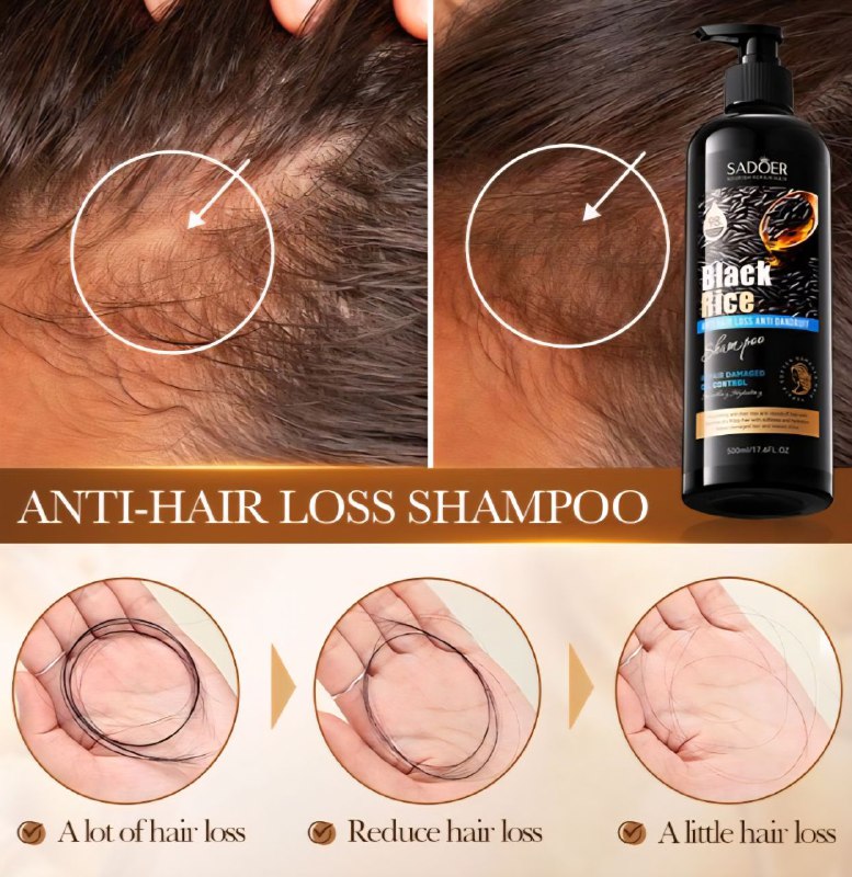 SHAMPOO PARA EL CABELLO DE ARROZ NEGRO QUE COMBATE LA CAIDA DEL CABELLO Y ELIMINA LA CASPA, LIMPIA PROFUNDAMENTE LAS IMPUREZAS, GRASA Y PUNTAS ABIERTAS, DEJANDOLO SEDOSO, BRILLANTE Y NUTRIDO SADOER 500ML