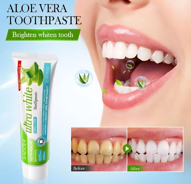 PASTA DE DIENTES, DE ALOVE VERA, DEJA LOS DIENTES BRILLANTES, ELIMINA MANCHAS DIFICILES Y SARRO BLANDO, DIENTES AMARILLENTOS, REFRESCA EL ALIENTO POR 12H SADOER 100G PASTA DENTAL