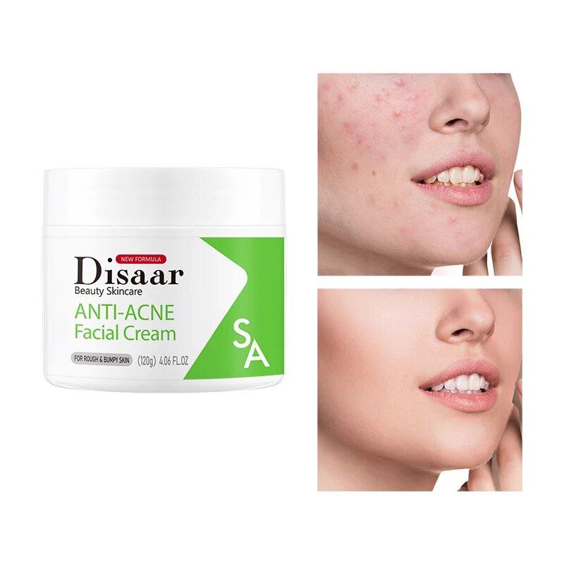 CREMA FACIAL ANTI ACNE ALTA CONCENTRACION DE COLAGENO DISAAR 120G
