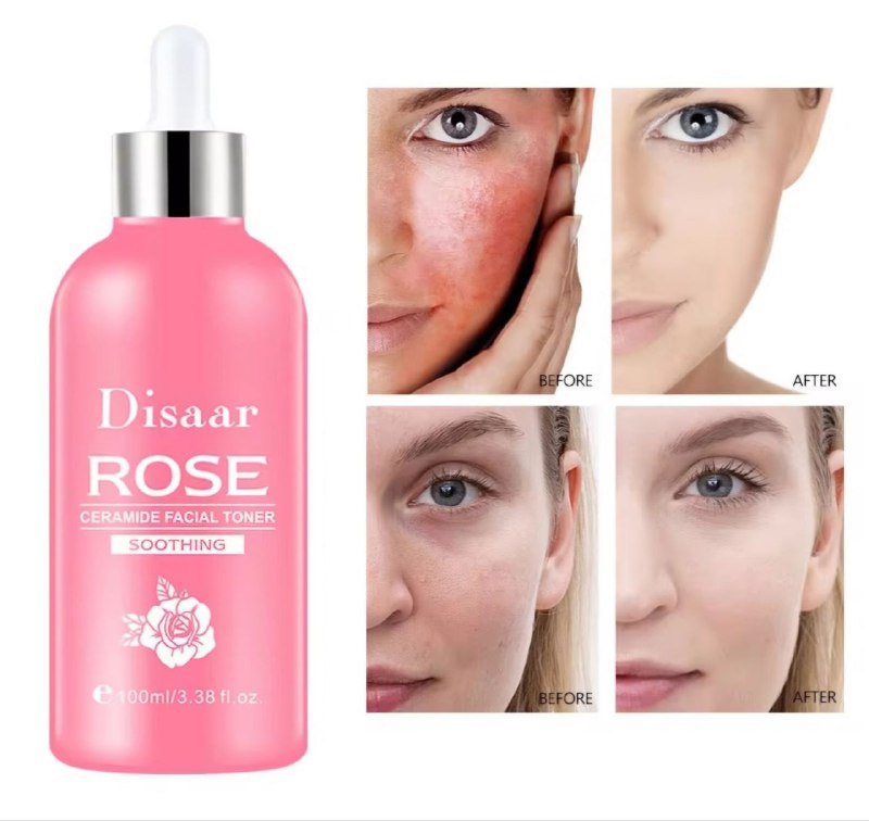 TONICO FACIAL CON CERAMIDA, CALMANTE, REPARADOR Y ILUMINADOR, BLANQUEA, HIDRATA, REAFIRNA LOS POROS DISAAR BEAUTY SKINCARE ROSE CERAMIDE 100ML