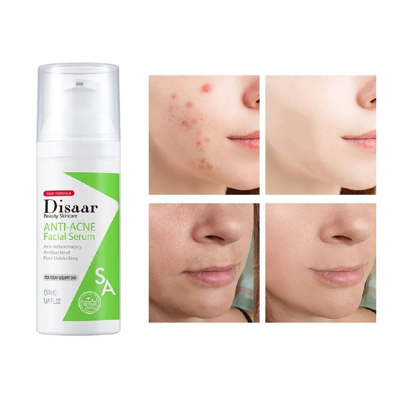 SUERO FACIAL ANTI ACNE EFICAZ DISAAR 50ML