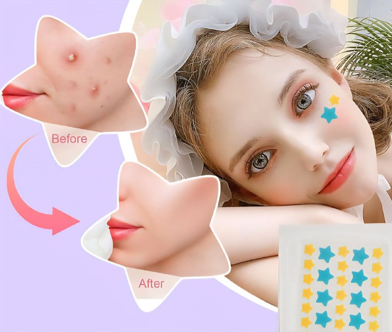 PARCHES PARA EL ACNE REDONDO Y ESTRELLA SADOER 36 PCS